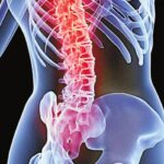 osteoporosi